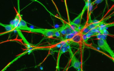 C9orf72 y su papel central en neurodegeneración