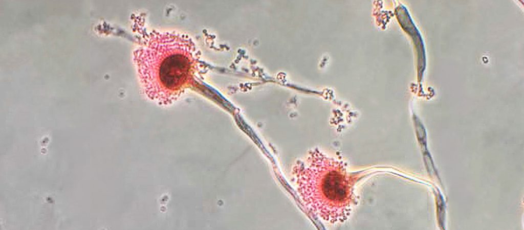 COVID 19 y co-infecciones por hongos