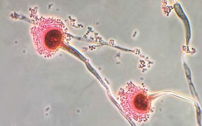 COVID-19 y co-infecciones por hongos