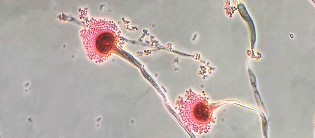 COVID-19 y co-infecciones por hongos