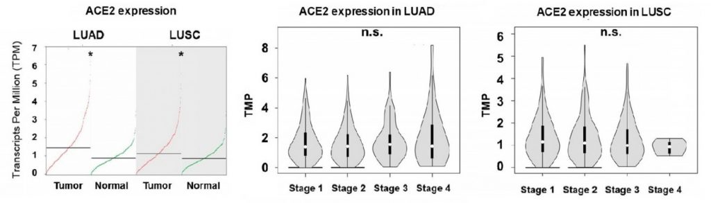 expresión de ACE2 en LUAD y LUSC es más elevada que en tejidos no tumorales en todos los estadios de la enfermedad