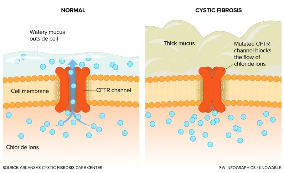 Canal de iones cloruro en membrana de células normales y en células de pacientes con fibrosis quística