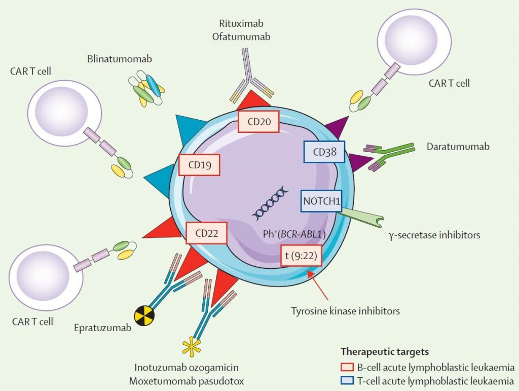 Terapia tratamiento leucemia linfoblástica aguda