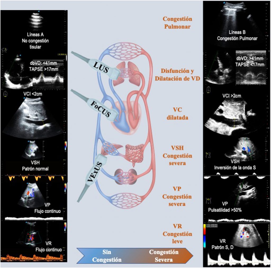 congestion y ultrasonido retos para la nefrologia de la proxima decada