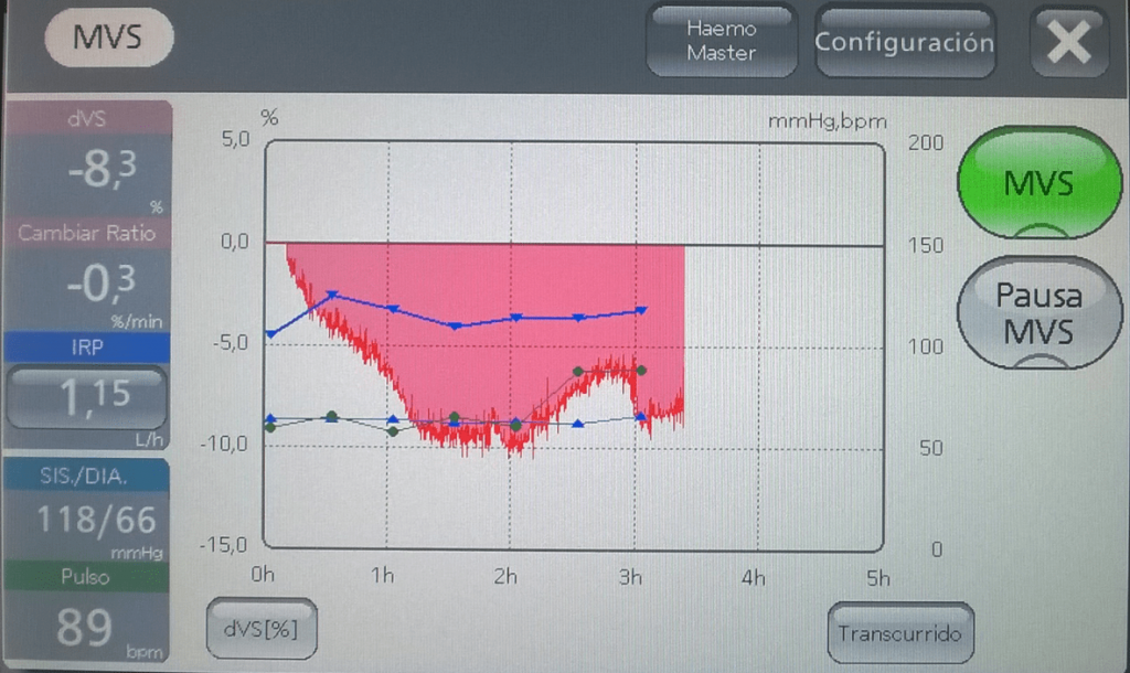 Monitor de Volumen Sanguíneo