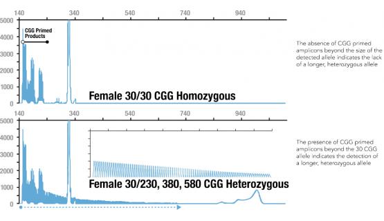 Diferencia en el patrón de picos de mujer homocigota y heterocigota