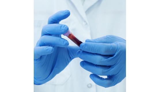 Preservar las muestras biológicas en las mejores condiciones