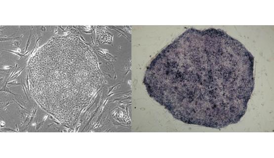 Imagen a microscopio de célula madre